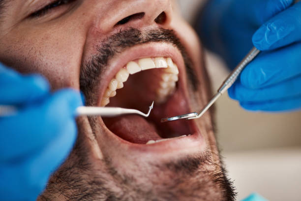  Garberville, CA Emergency Dentist Pros