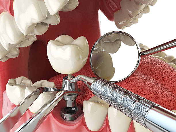Best Emergency Gum Pain Relief  in Garberville, CA