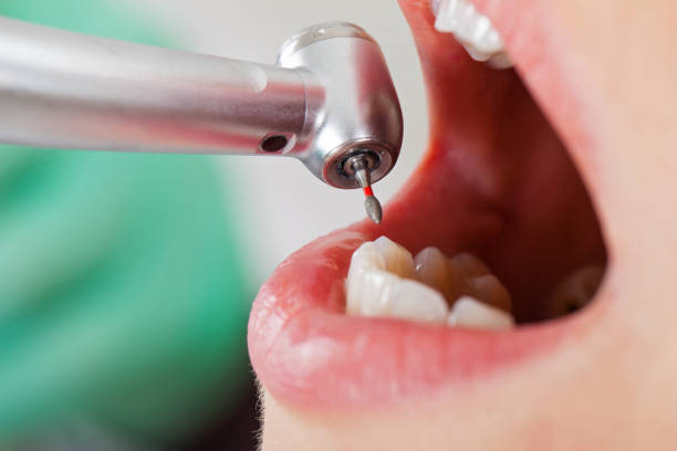 Best Dentist for Dental Trauma  in Garberville, CA